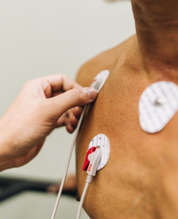 Cardioversion Procedure