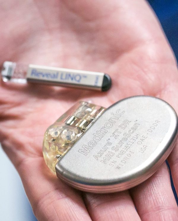 Pacemaker Implantation
